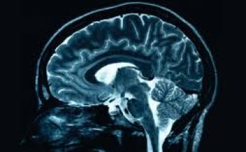 Áttörést jelenthet a magyar agykutatók tanulmánya