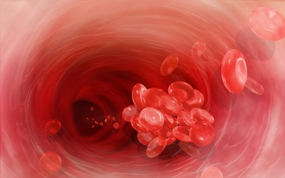 Idősebb korban akár 100-szorosára is nőhet trombózis kialakulásának esélye 