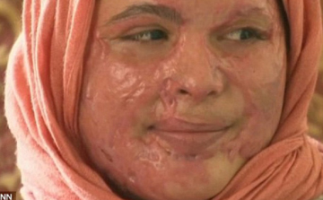 Hihetetlen! Halálos boszorkányüldözés a XXI. században! 