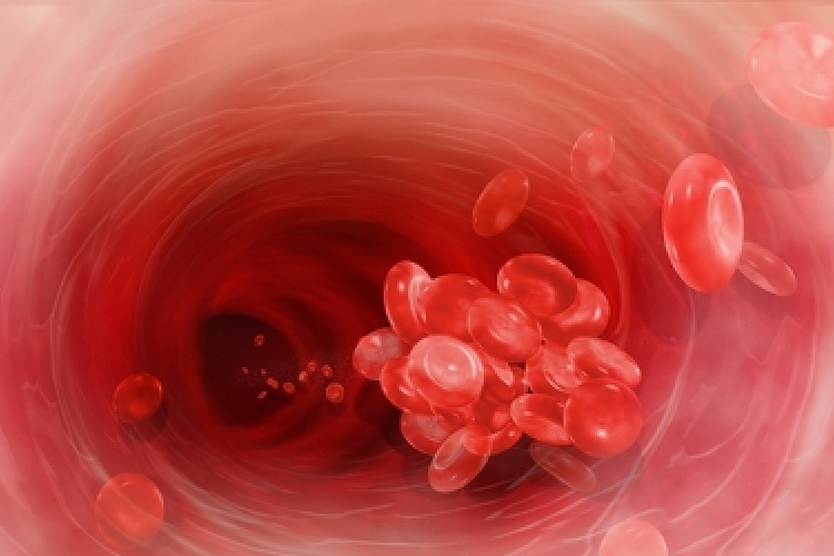 Idősebb korban akár 100-szorosára is nőhet trombózis kialakulásának esélye 