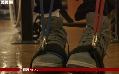 Áttörést jelentő sejtátültetés után újra jár egy bénult férfi