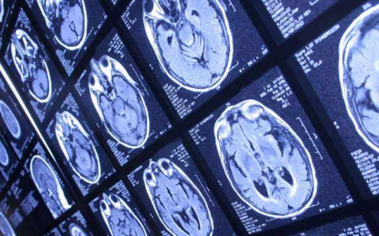 Megváltoztatja az agy szerkezetét a multitasking?