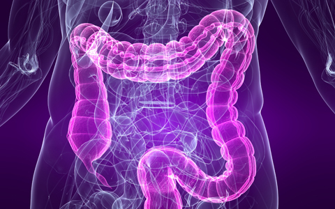 Hogyan előzhető meg a vastagbélrák? 