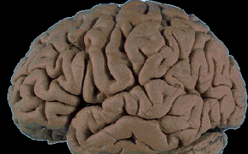 Mini agyat hozták létre őssejtekből