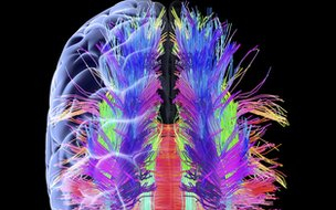 Megtalálták az időskori emlékezetromlásért felelős fehérjét